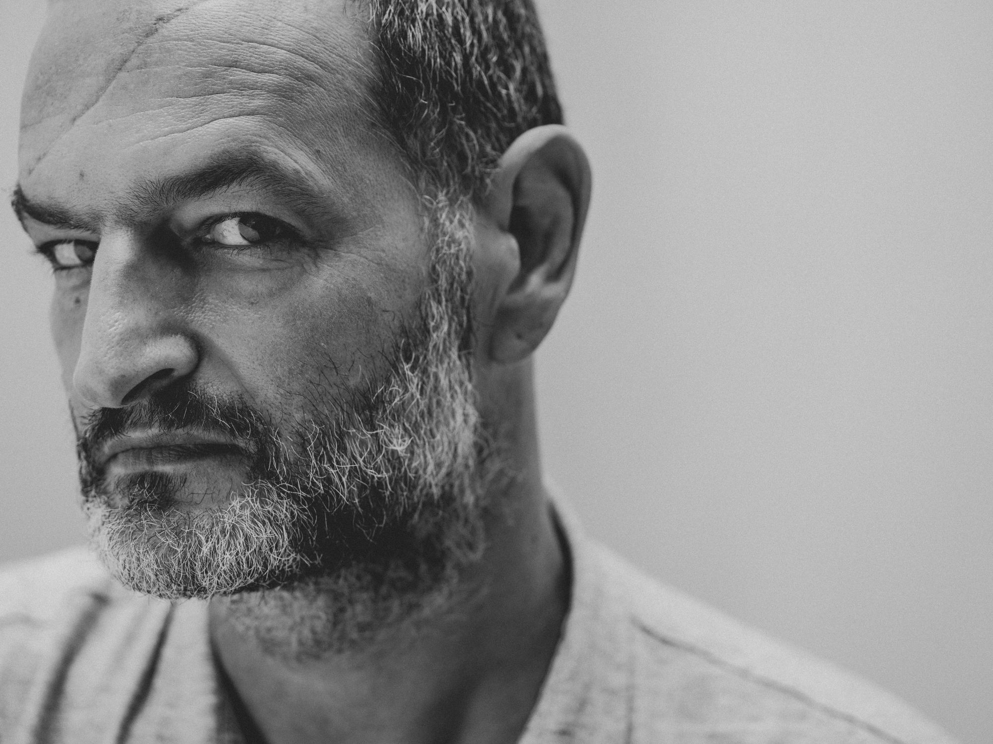 Alex talks about the collision that nearly took his life, but left him with a scar in One of a Million: Survivor Stories