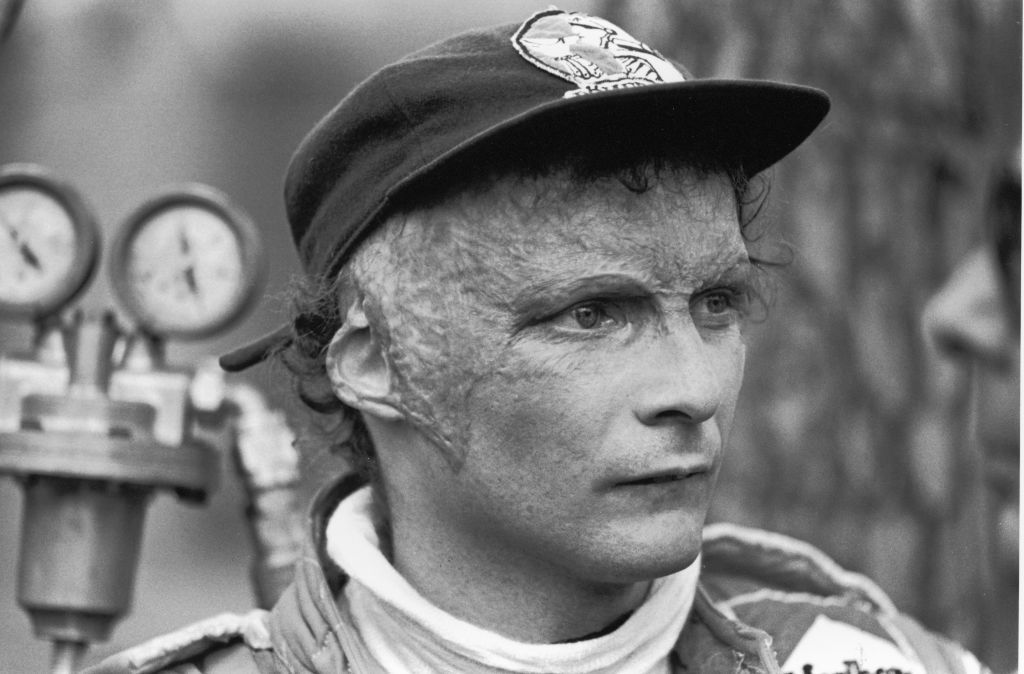 Austrian Grand Prix racing car driver Niki Lauda watches, late 1970s. Lauda was badly burned in a crash during the 1976 season but returned to race shortly afterwards. (Photo by Robert Riger/Getty Images)