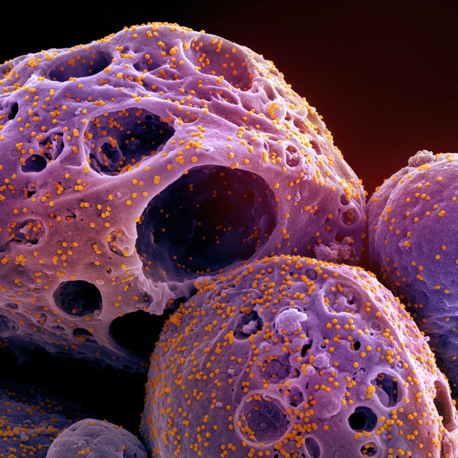 Corona Virus (Photo: National Geographic)