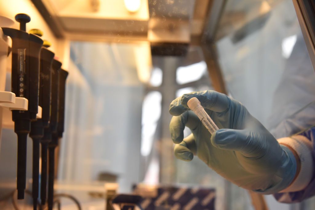 LVIV, UKRAINE - FEBRUARY 7: An employee demonstrates a test tube with DNA particles at the laboratory of molecular genetic examinations in Lviv, February 7, 2023. During the Russian-Ukrainian war, the main purpose of the laboratory will be to identify the bodies of dead Ukrainian soldiers. Also, at the international level, examinations using the DNA analysis method will be conducted here to identify the bodies of the deceased, unknown persons, biological traces on physical evidence, etc. (Photo by Pavlo Pal