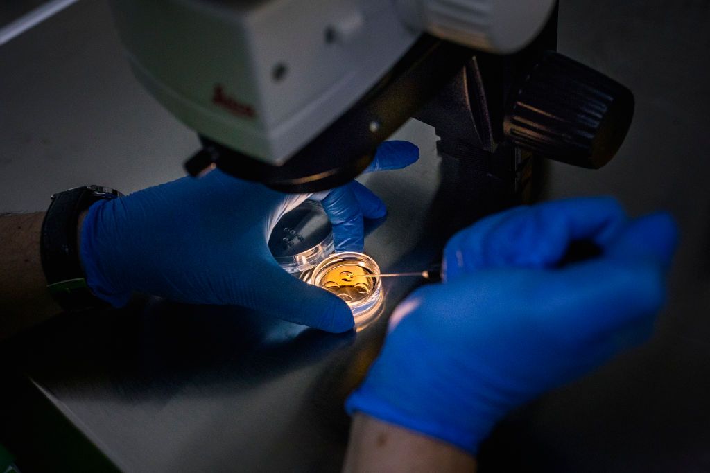 TBILISI, GEORGIA - 2019/12/19: Inside a lab at a clinic in Tbilisi, Georgia, Doctor Jordan from Spain, is doing an artificial insemination into an egg that later will be planted into a Georgian surrogate mother.The country of Georgia has become a hub for the international surrogate industry, driven by the poverty of domestic surrogate mothers and the desire of foreign customers to have a child. (Photo by Jonas Gratzer/LightRocket via Getty Images)