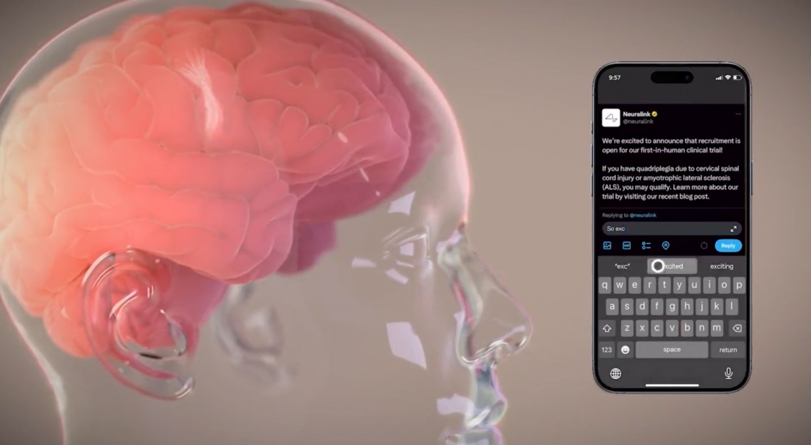 Neuralink wants to create products that allow users to control their smartphones with their minds (Photo: Neuralink)