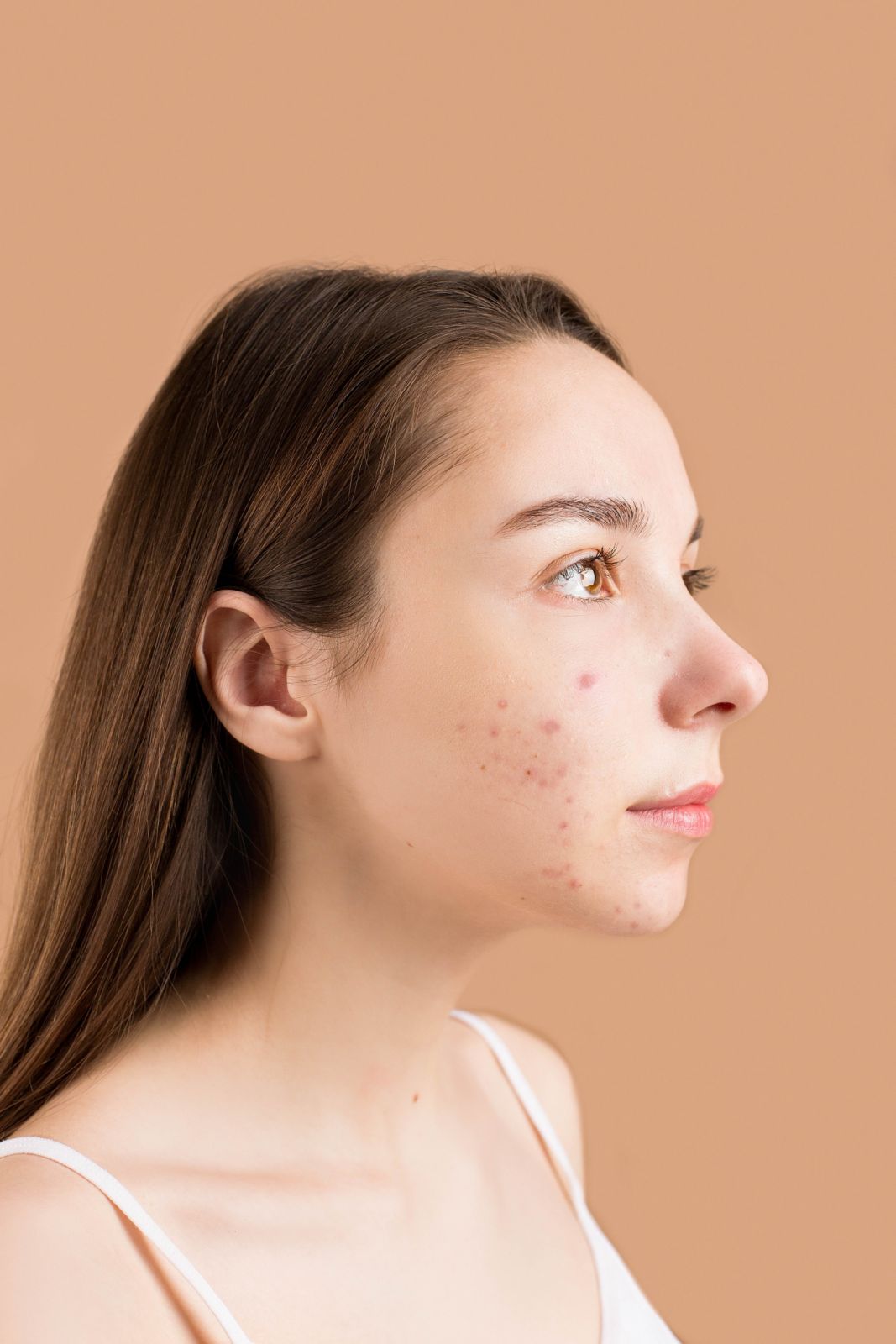 Using retinols can cause 'skin purging' (Photo: Photo by Anna Nekrashevich/Pexels)