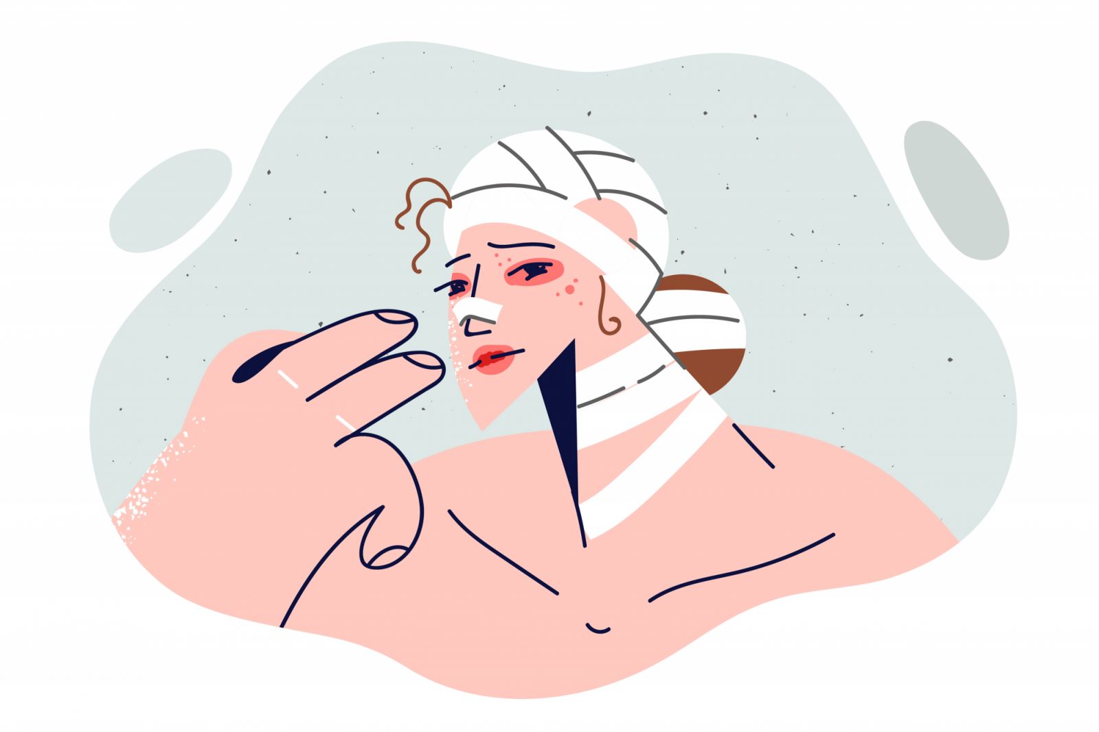 Injured woman with bandages on head and band-aid on nose was victim bandit who inflicted injuries after robbery. Injured girl needs qualified medical assistance to get rid consequences of car accident