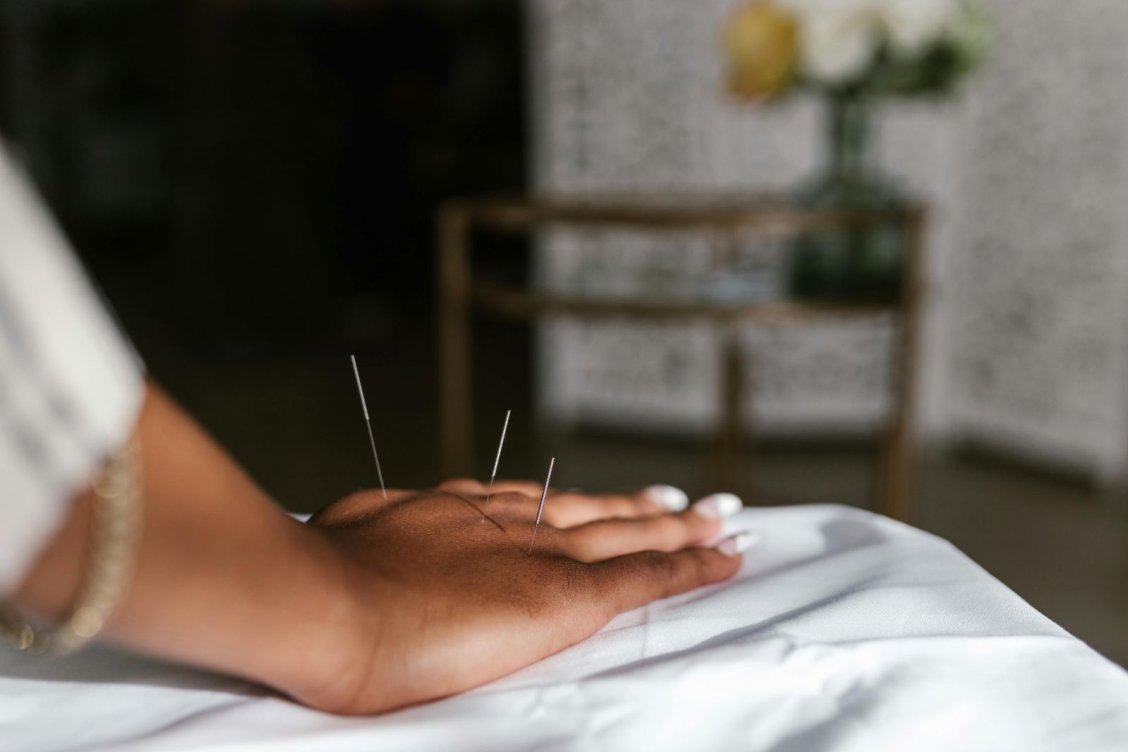 A person having an acupuncture treatment (Photo: RDNE Stock project / Pexels)
