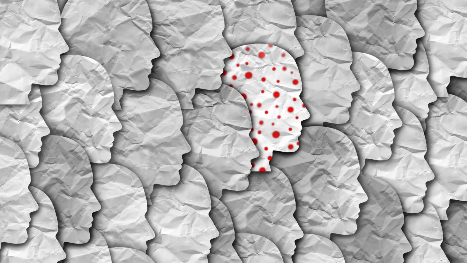 Monkeypox infectious disease outbreak as a contagious infection as blisters and leisons on the skin representing transmission of an infected person in a population. (Photo: Getty Images)