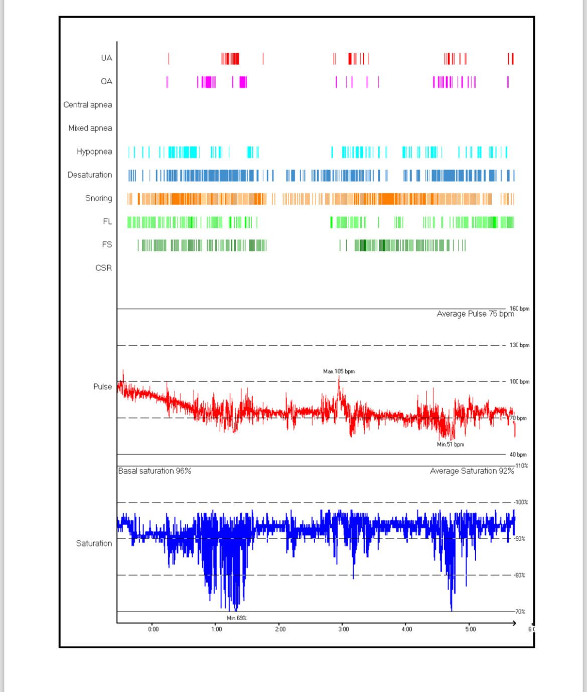 A comprehensive snapshot of your sleep quality with detailed results from the sleep study