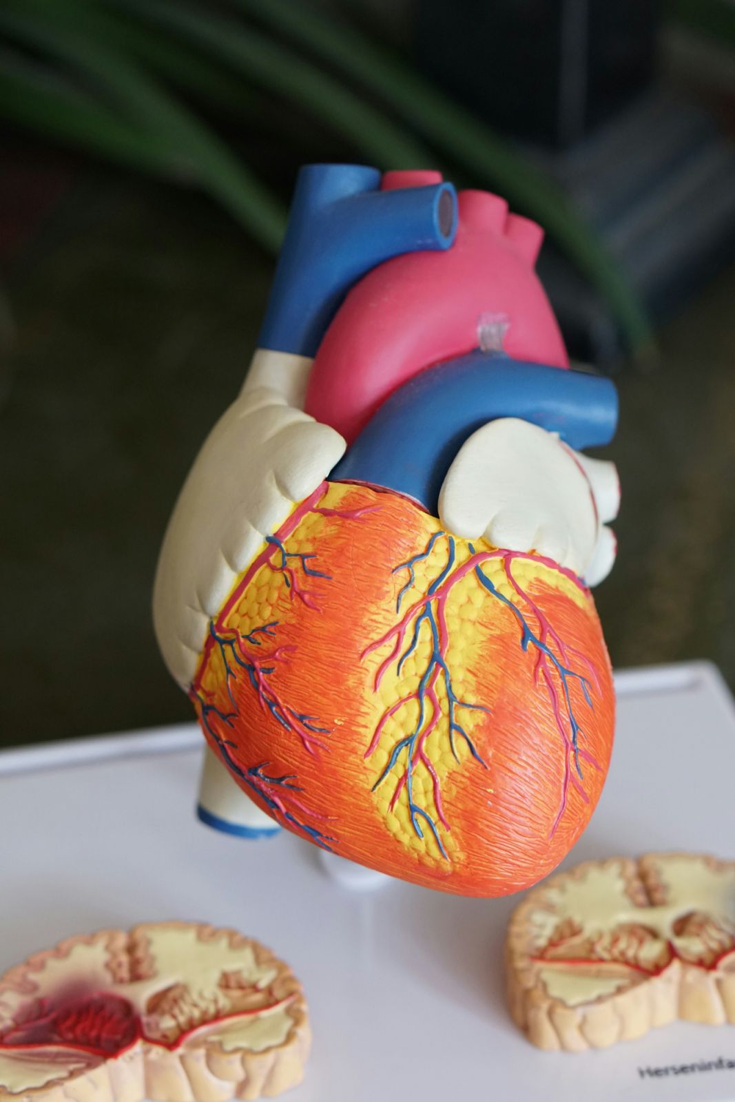 High blood glucose from diabetes can damage blood vessels and the nerves that control one’s heart and blood vessels which can lead to heart disease (Photo: Unsplash)