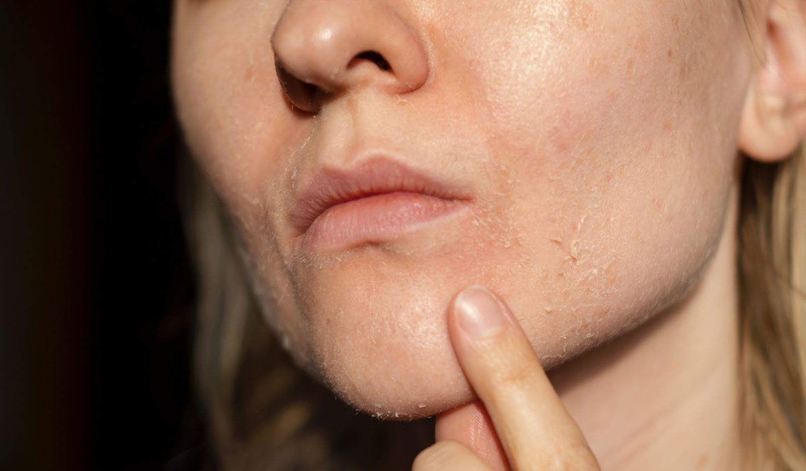 Your hormones, environment, and stress affect your skin according to Dr Kaycee Reyes (Photo: Getty Images)