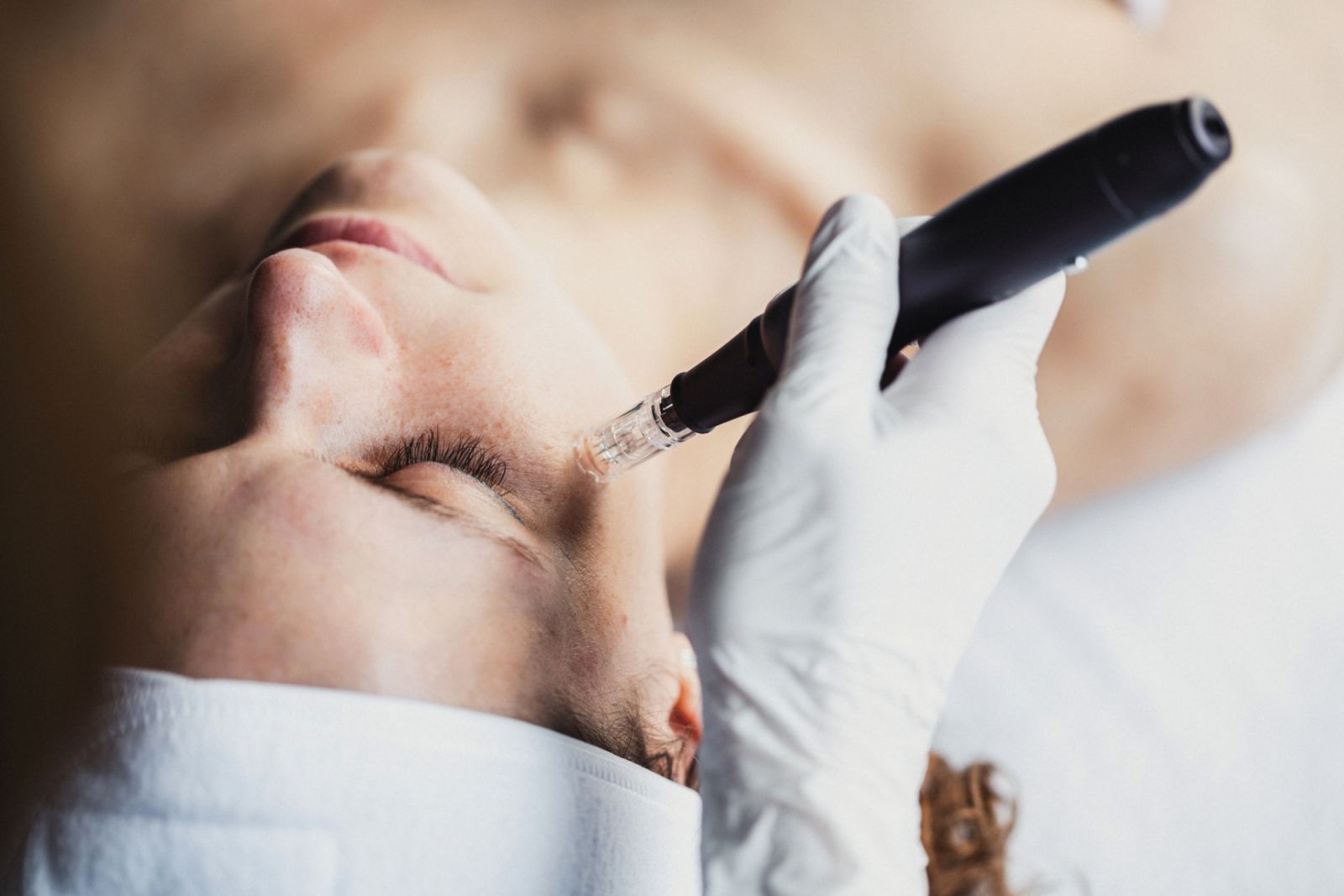 Dr Aivee Teo explains that regular consultations with skin experts are essential to tailor the treatment frequency to one’s specific needs (Photo: Getty Images)