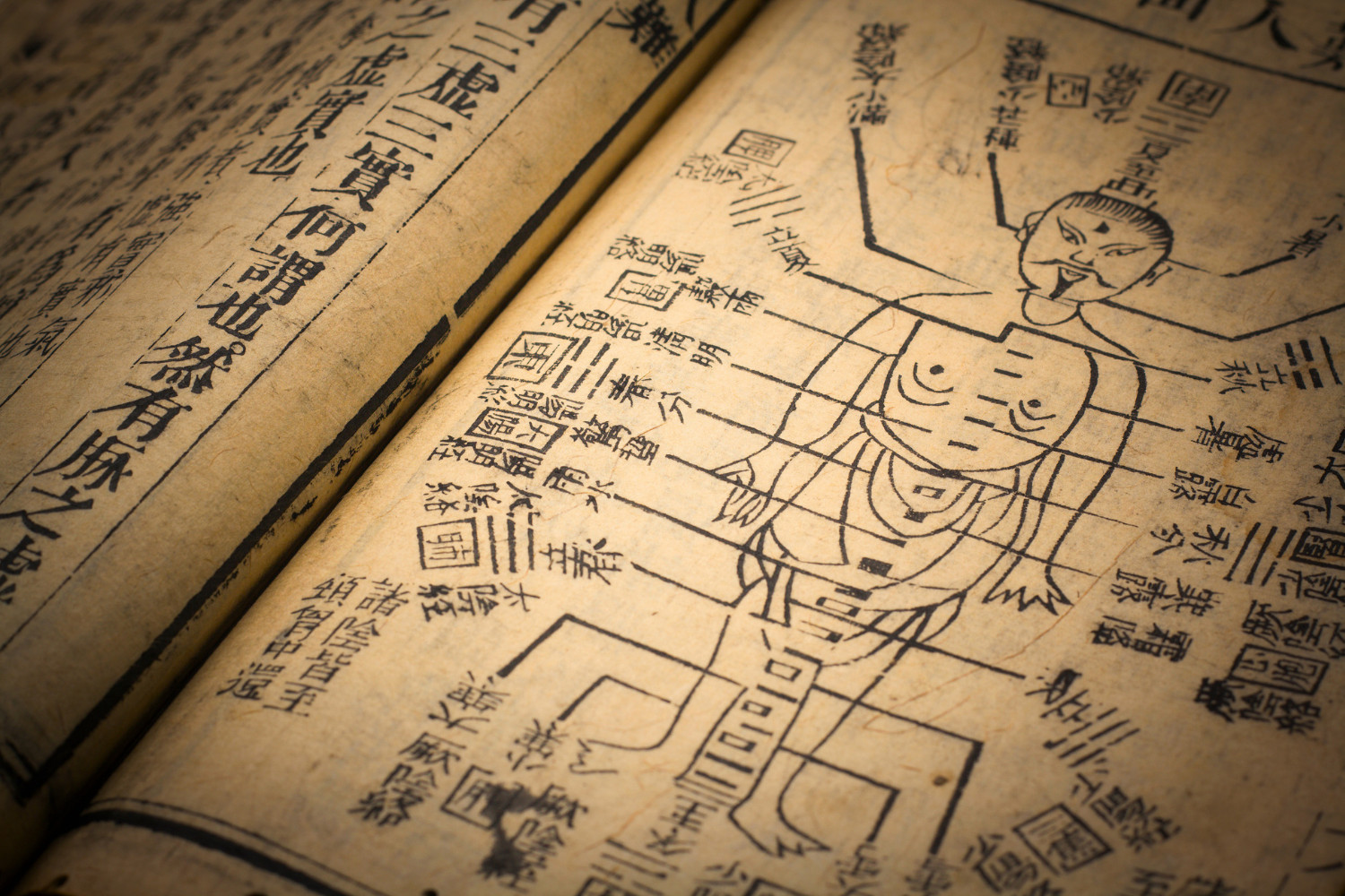 An antique Chinese medical text featuring an acupuncture chart.