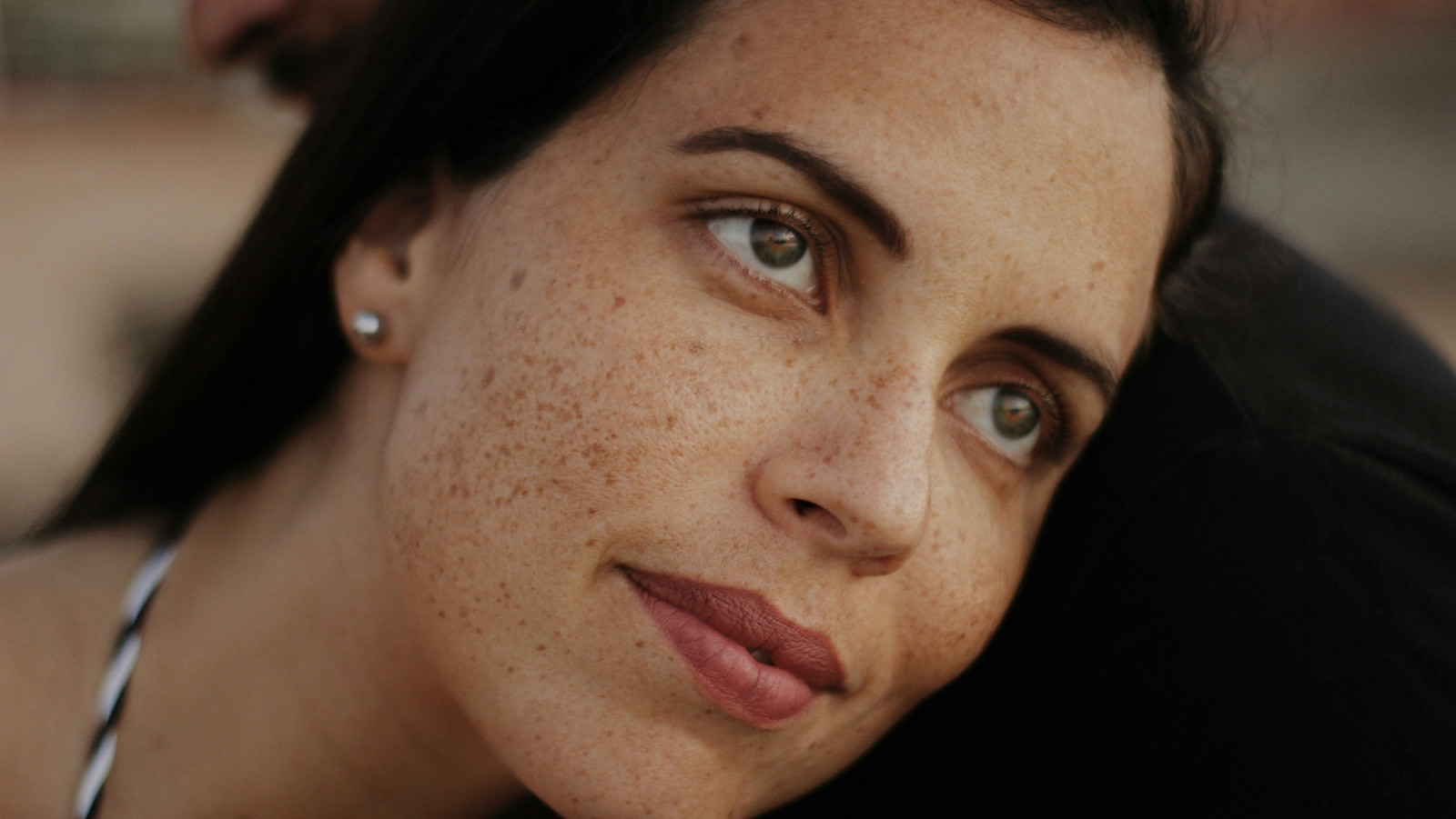 Woman with sunspots on face