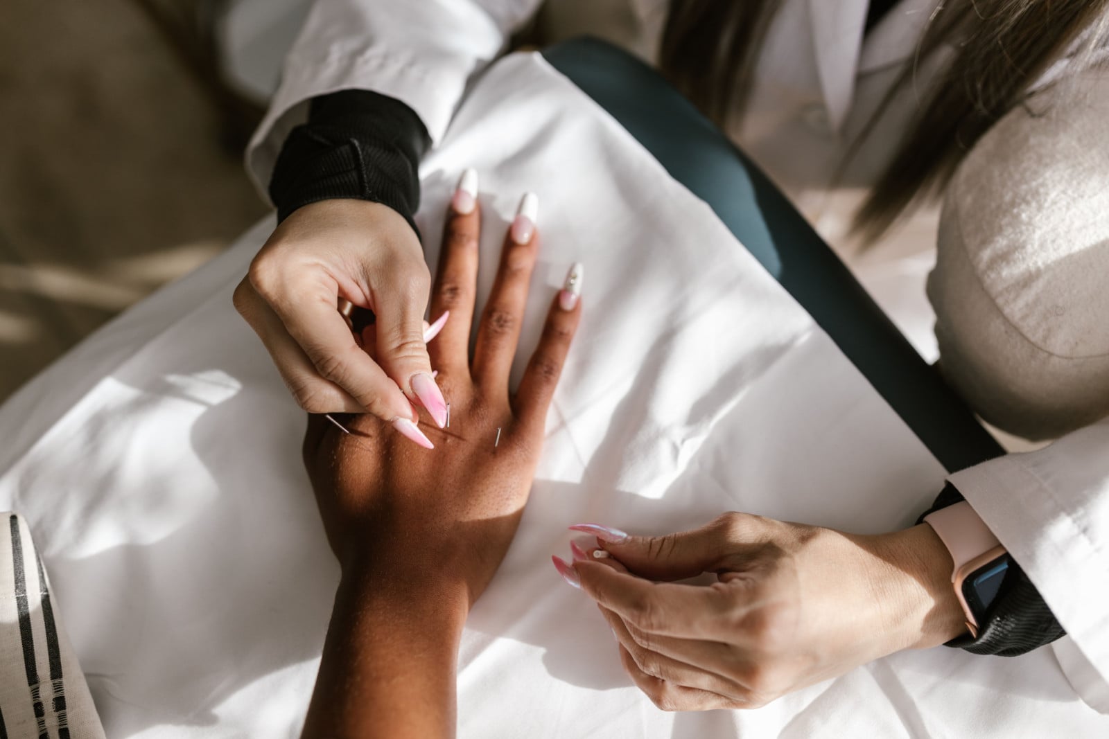 A practitioner administers acupuncture therapy to a patient's hand.